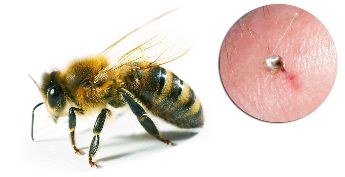 Курамына Hondrostrong кирет пчелиный яд жакшырта турган экономиканын алмашуу процесстери ткандарда
